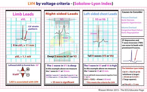 LVH